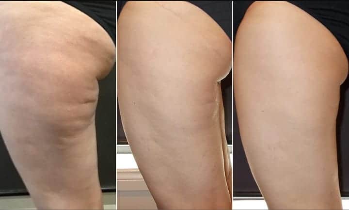velasmooth risultati